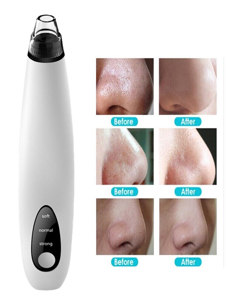 SmartPore™ Blackhead  Remover