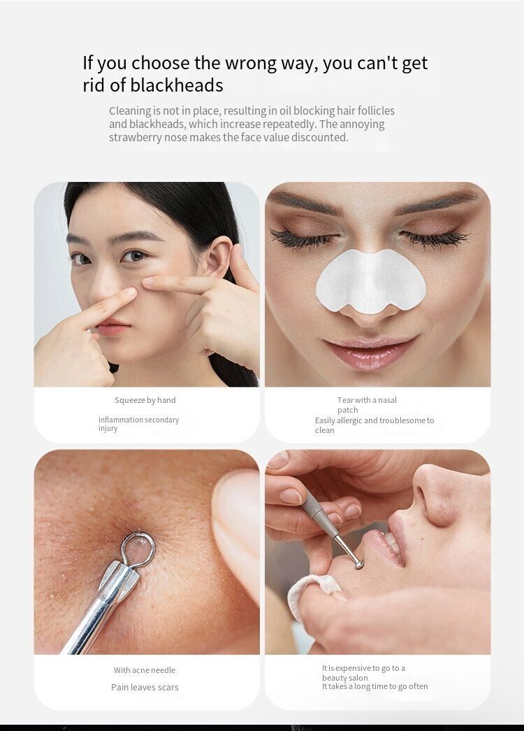 SmartPore™ Blackhead  Remover